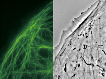 用CFI Apochromat TIRF 100XC油物镜捕获的GFP-α-微管蛋白标记的PTK-1细胞