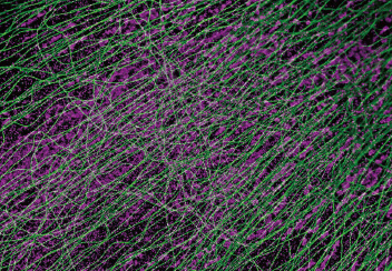 25mm视野神经元图像
