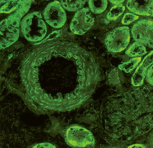 fitc染色后的小鼠肾脏荧光染料fitc主要用于在免疫学的抗原抗体反应.
