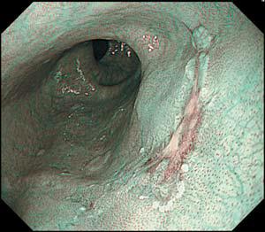 GIF-H290_5.jpg