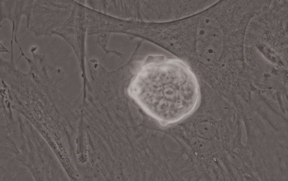 诱导多能干细胞的Nanog基因表达（绿色荧光蛋白）