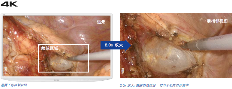 4K变焦