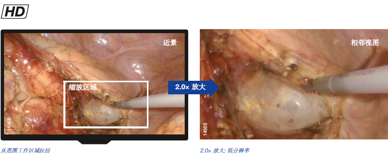 高清变焦