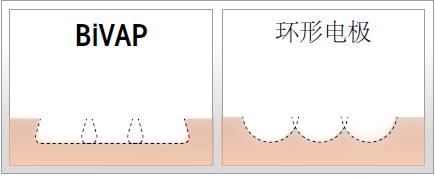 缫