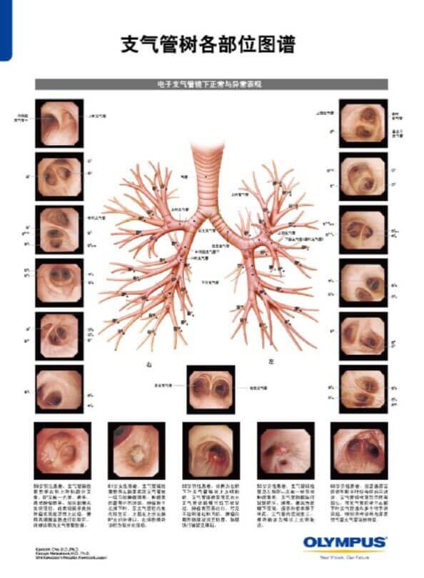 支气管树各部位图谱