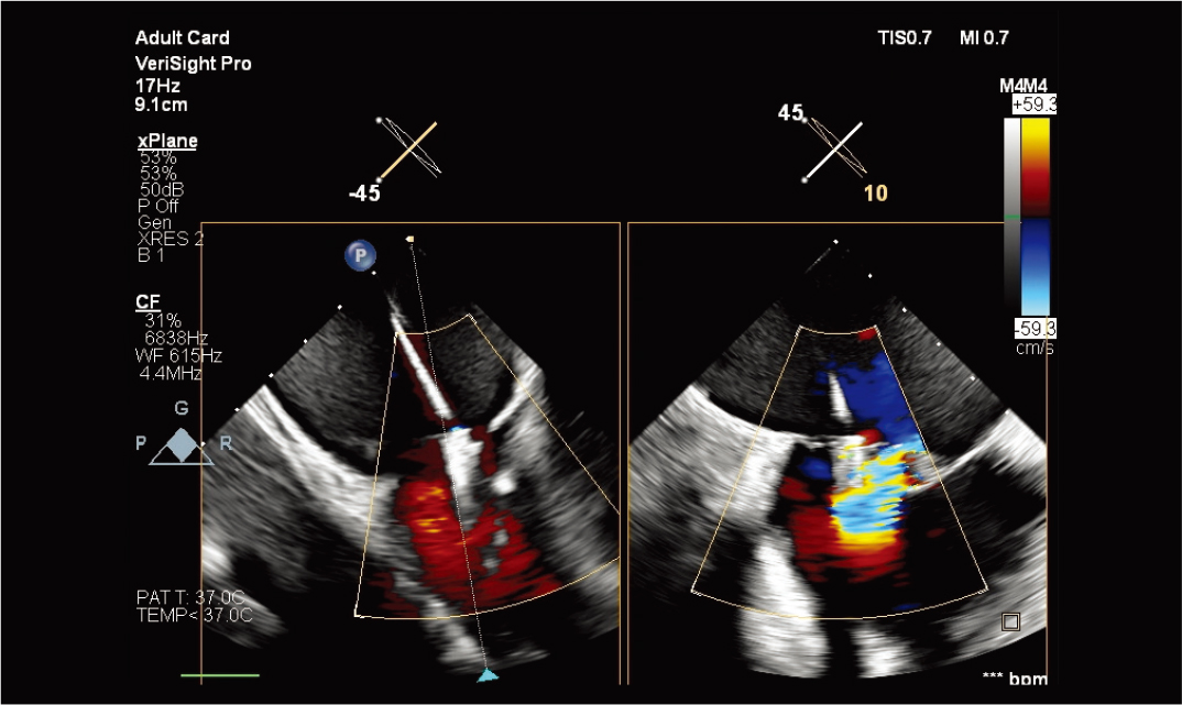 ʹ��&nbsp;VeriSight&nbsp;Pro&nbsp;����&nbsp;xPlane&nbsp;����