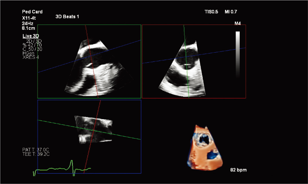 ���������&nbsp;MPR&nbsp;��ͼ��&nbsp;TrueVue&nbsp;�ݻ�