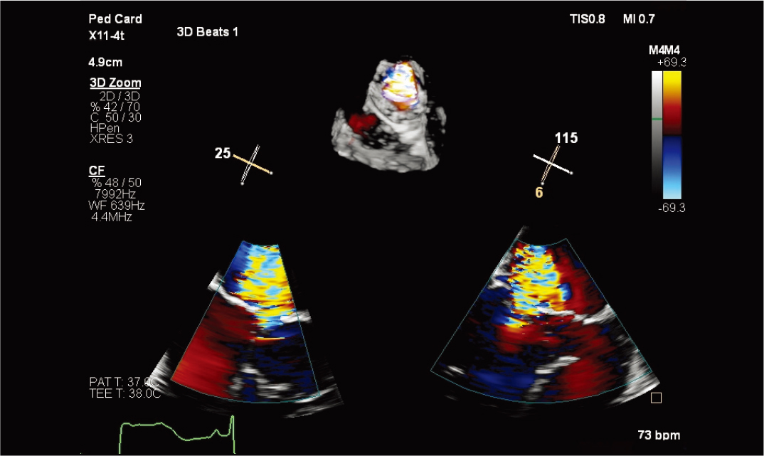 X11-4t&nbsp;̽ͷ�Ķ���&nbsp;3D&nbsp;��ɫ