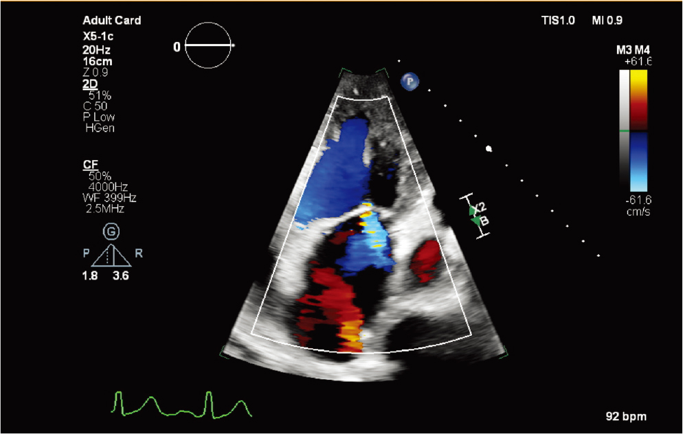 X5-1c&nbsp;̽ͷ��ɫ�����ն���귵��(MR)