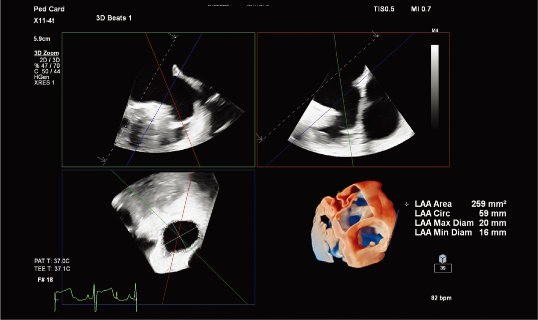X11-4t&nbsp;̽ͷ���ж������Ķ�����