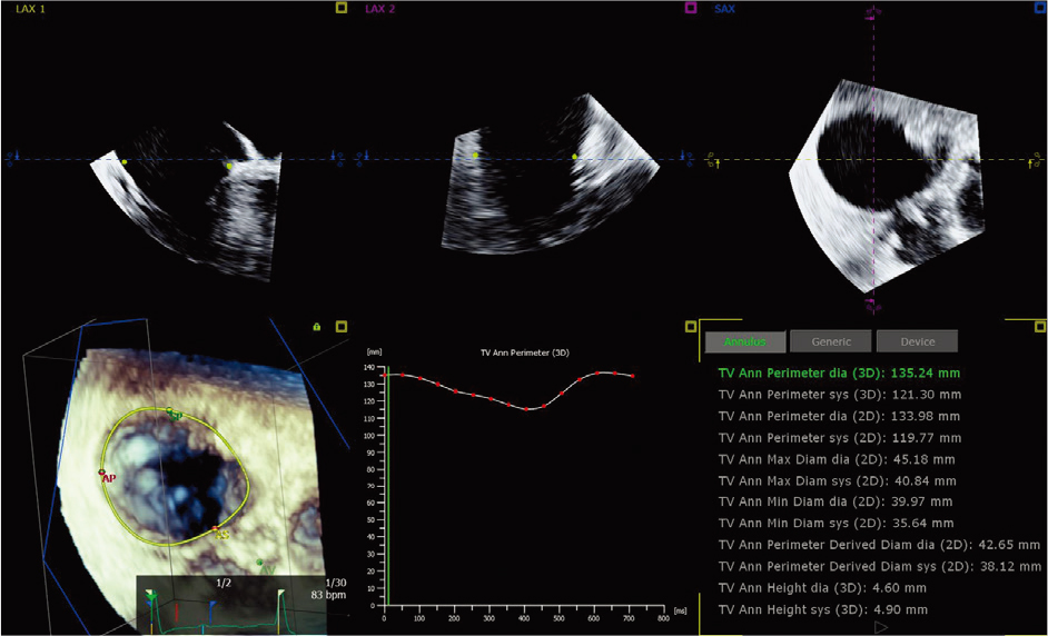 3D&nbsp;�Զ�����궨��