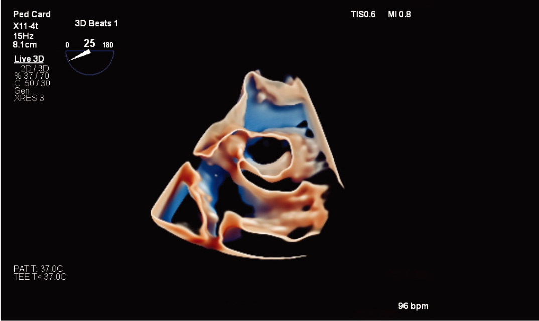 X11-4t&nbsp;̽ͷ��&nbsp;TrueVue&nbsp;���а���Ĥ���