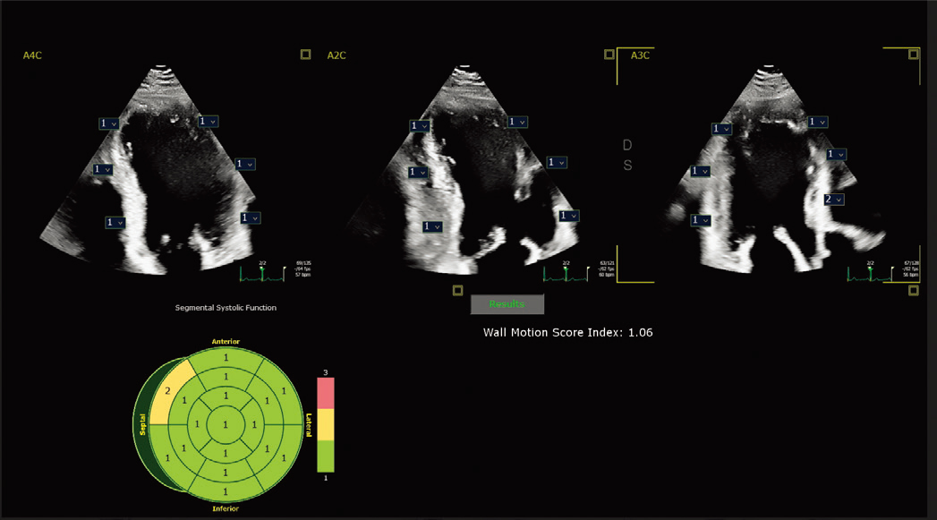 X5-1c&nbsp;̽ͷ�����Զ��ڶ����ұ��˶�����ָ��