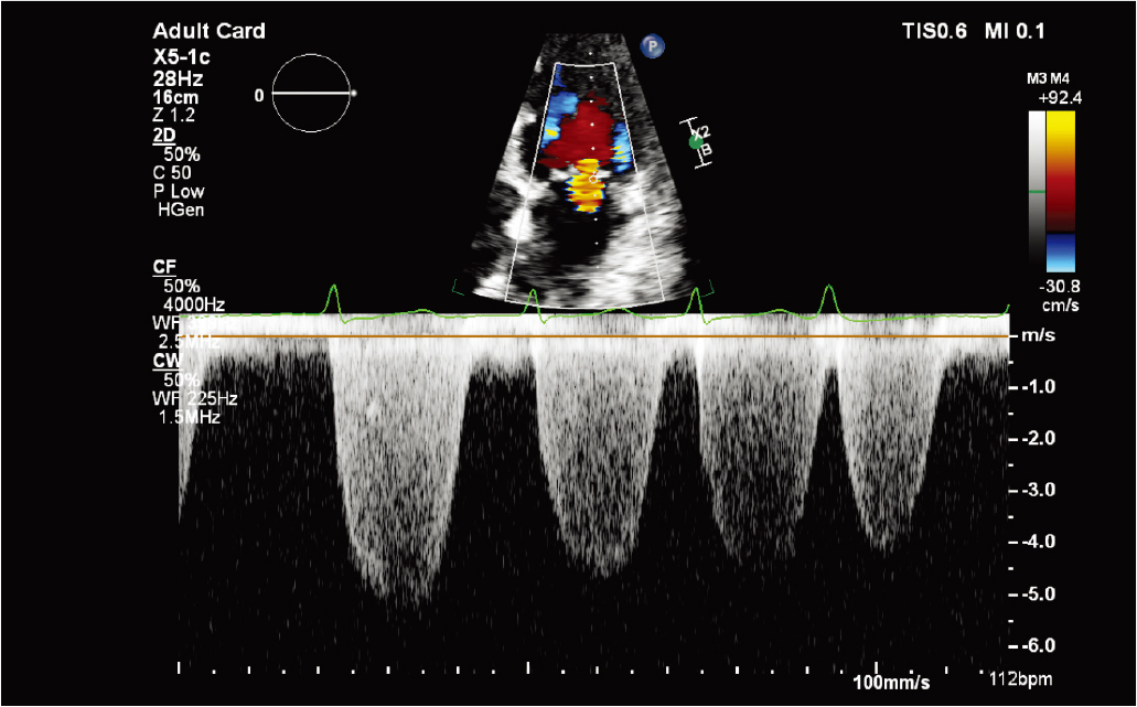 X5-1c&nbsp;�Ź���&nbsp;CW&nbsp;������̽ͷ