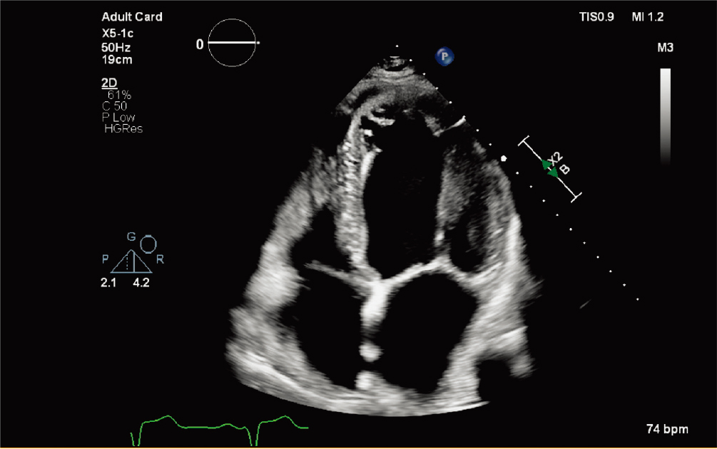 X5-1c&nbsp;̽ͷ�䱸&nbsp;nSight&nbsp;Plus