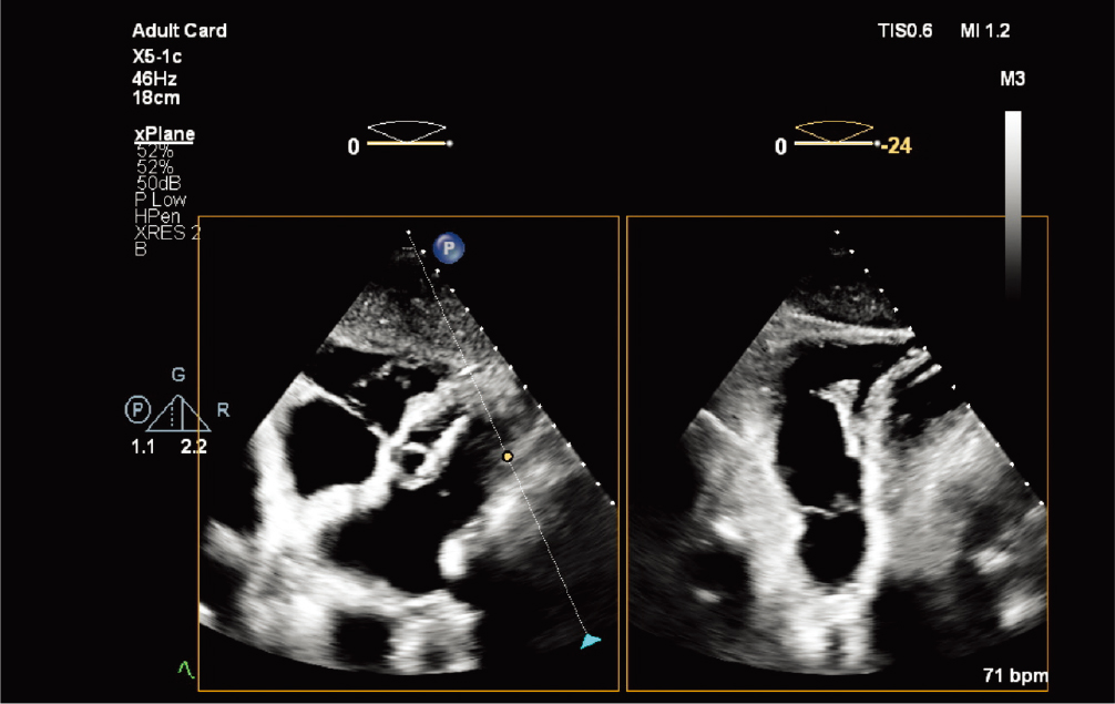 X5-1c&nbsp;̽ͷ����&nbsp;xPlane&nbsp;�ζ���ͼ��
