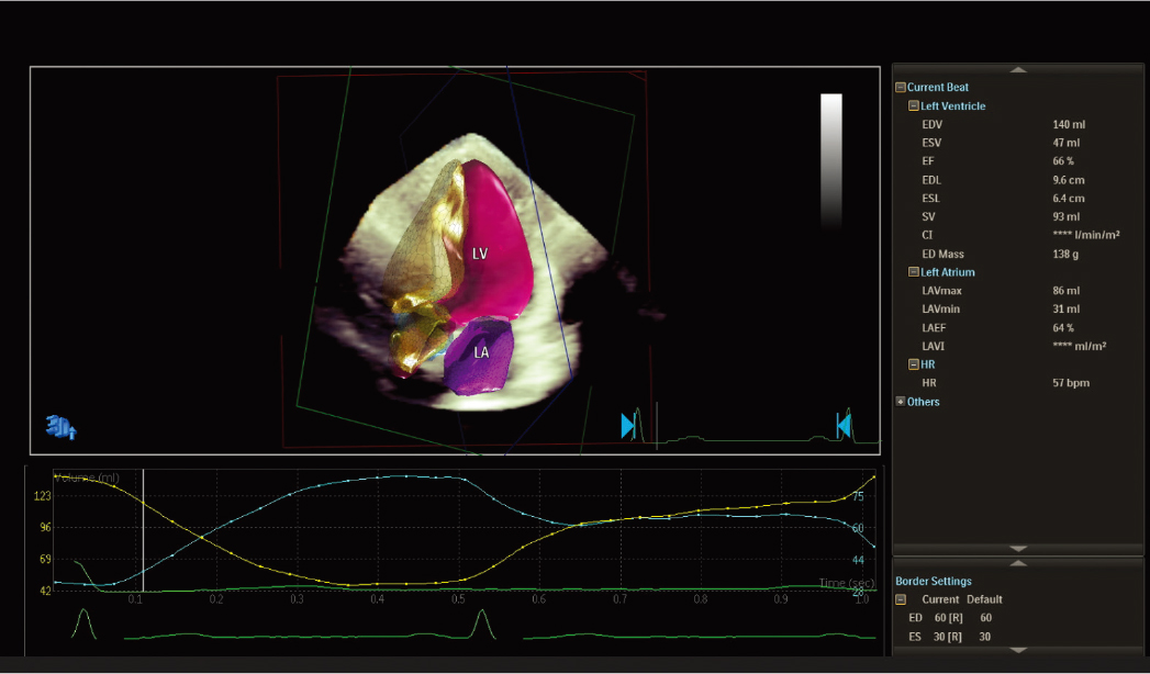 X5-1c&nbsp;t̽ͷ�Ķ�̬����ģ��