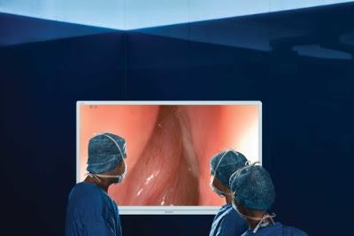 奥林巴斯推出Visera 4K超高清系统，用于耳鼻喉和腹腔手术