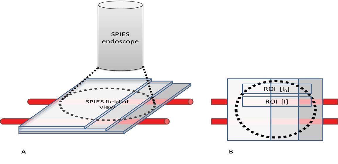 Storzרҵͼǿϵͳ(SPIES)