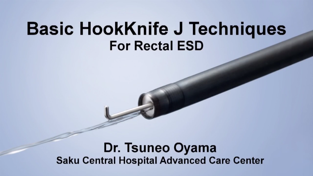 肠镜ESD中HookKnife J 的基础应用