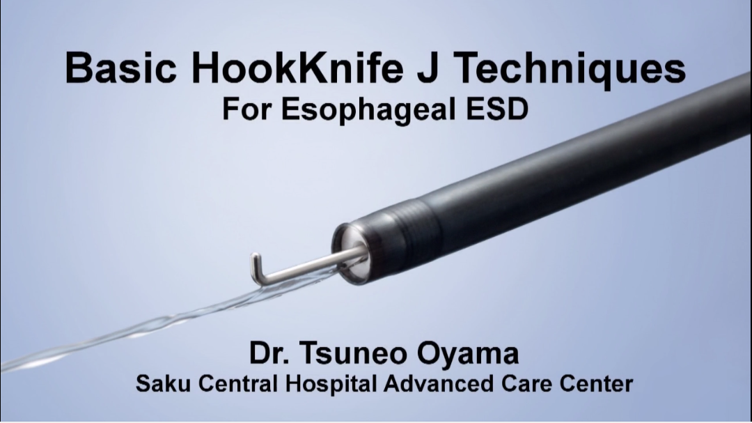 食道中内镜粘膜下剥离术ESD钩刀的的基础应用