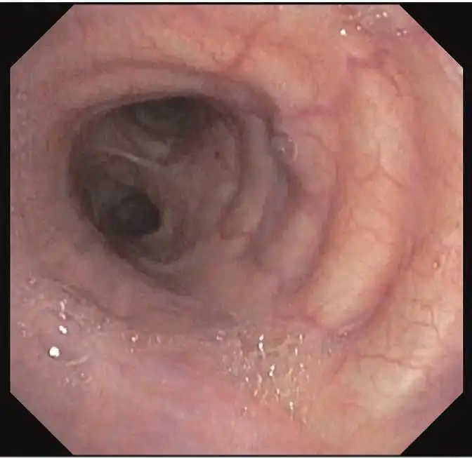 �߷ֱ��ʵ�ͼ������