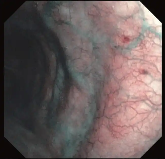 խ������