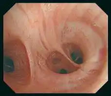 BF-H290����ͼ��