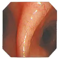 �߷ֱ���ͼ��