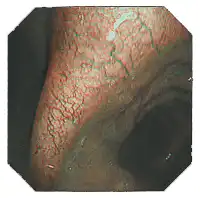 խ������