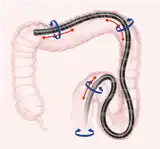 �ƶ���������Ťת����