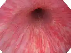 ������Ƶ���׾�