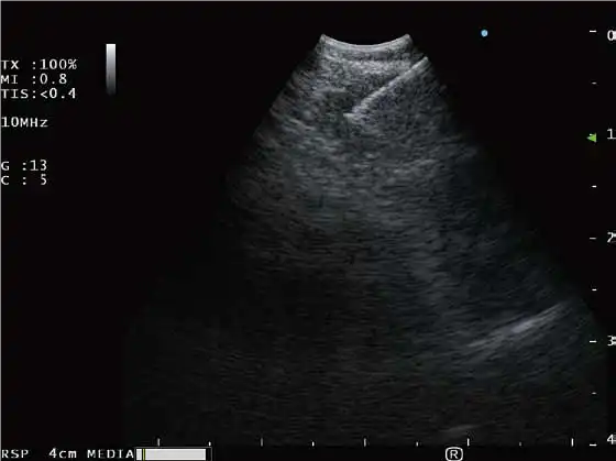 ����͹��ɨ��