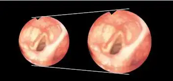 ͼ��ߴ�������25��