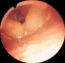 ���ָ߷ֱ���