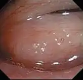 ������Խ�����