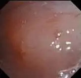 ������Խ�����