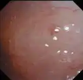 ������Խ�����