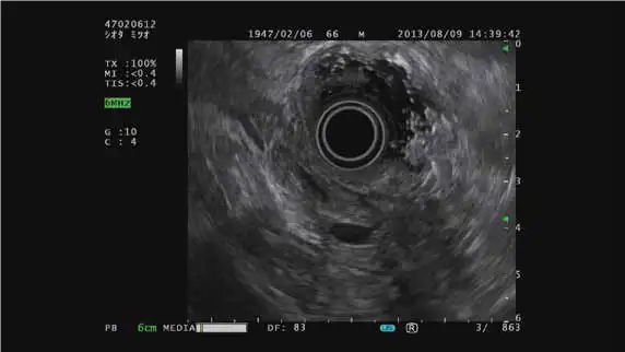 ���ӻ���ɨ��