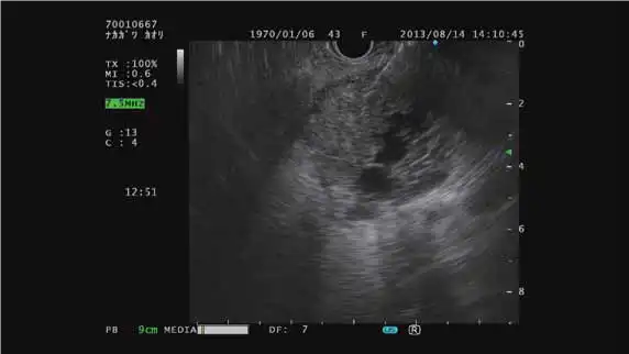 ����͹��ɨ��