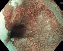 NBI�����۽�