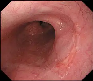 HDTVͼ������