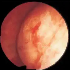 �߷ֱ��ʺ�����