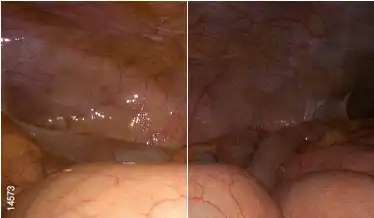 ������ͼ��