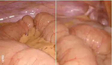 �Զ��Խ�ͼ��