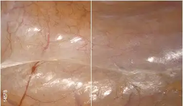 û���ڵ���ͼ��