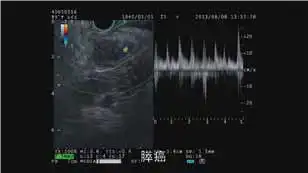 ���岨�����գ�PW��ģʽ