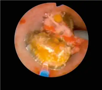 50,000��ά*���������ػ�